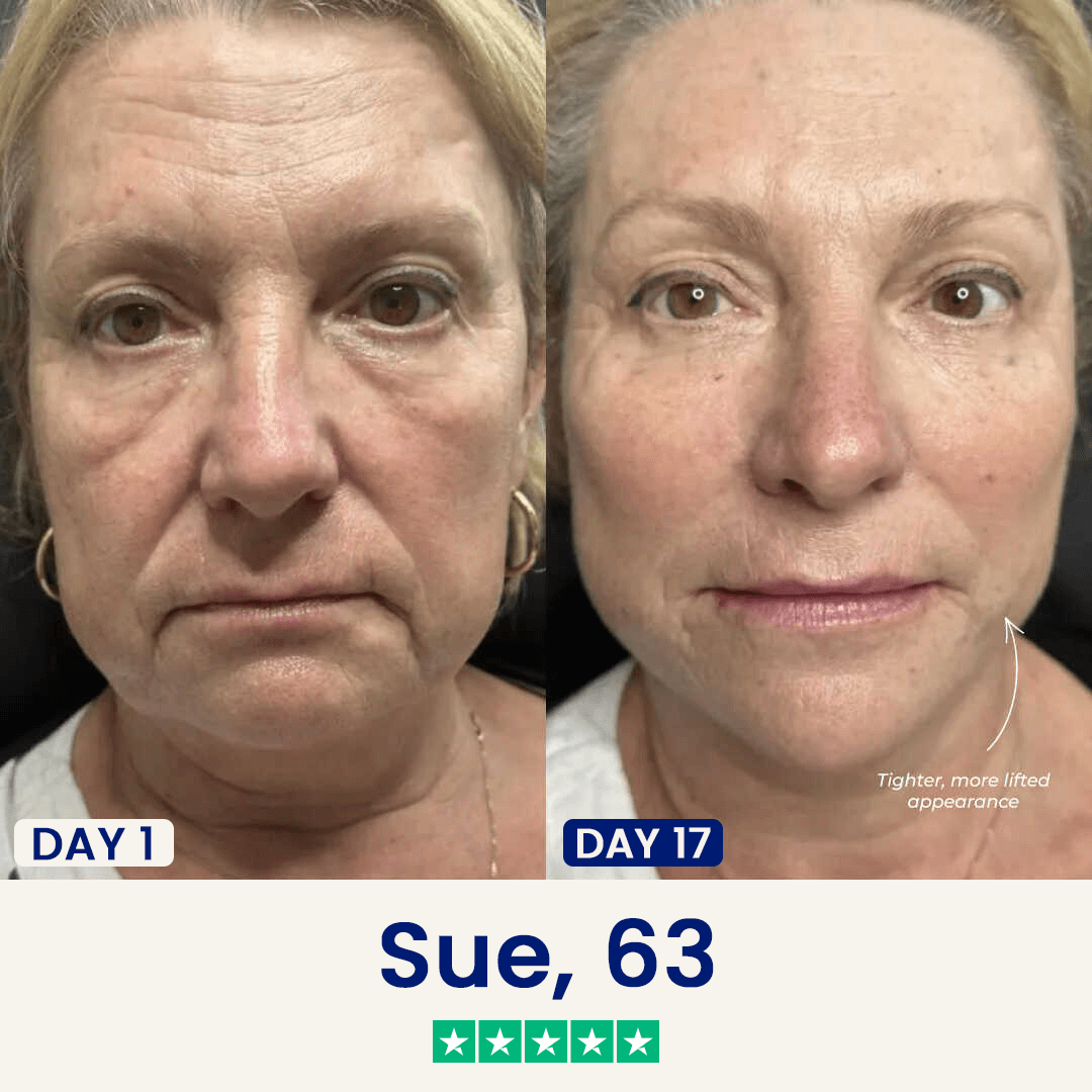 The Chinology™ Lift (2025 Version)