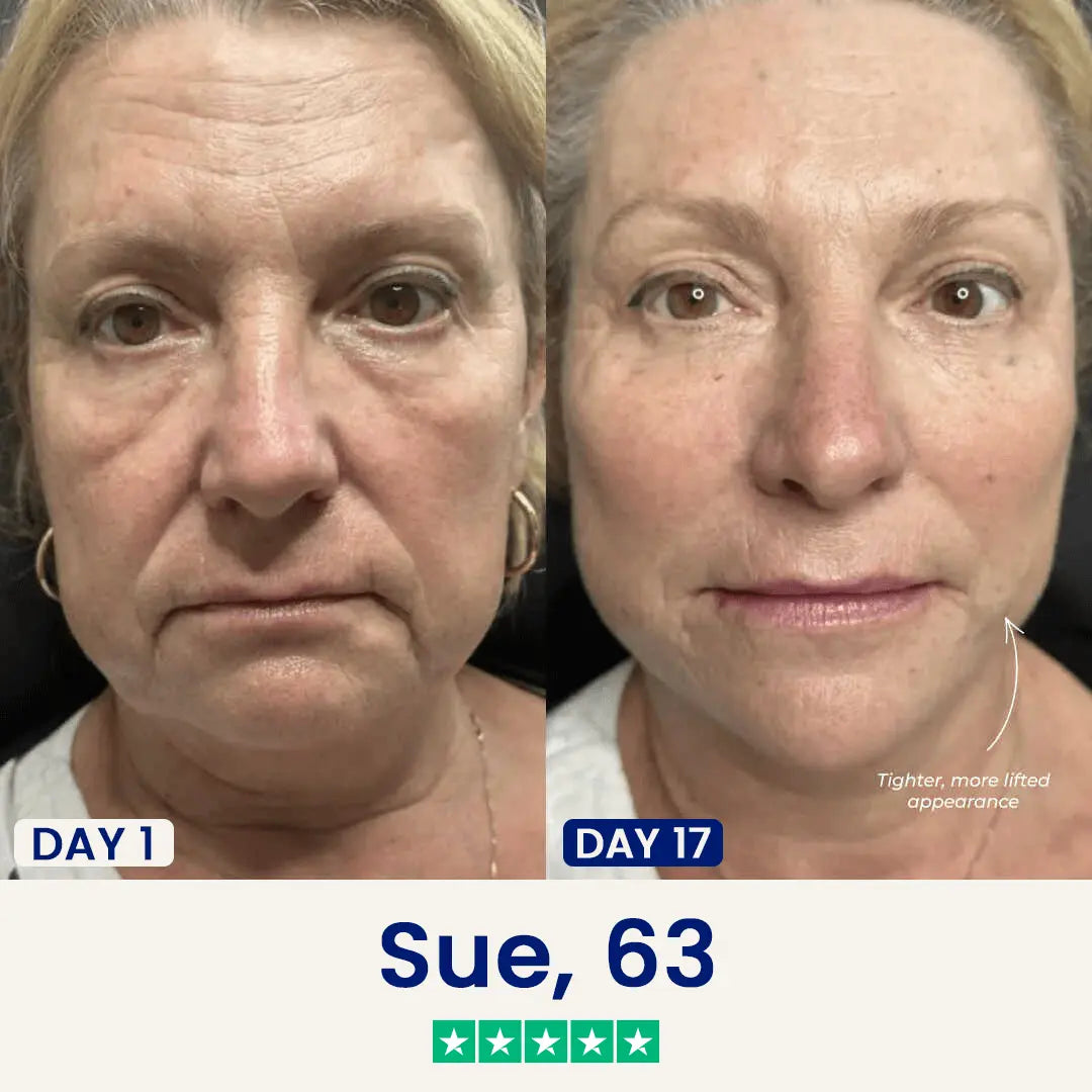 The Chinology™ Lift (v3) Chinology US