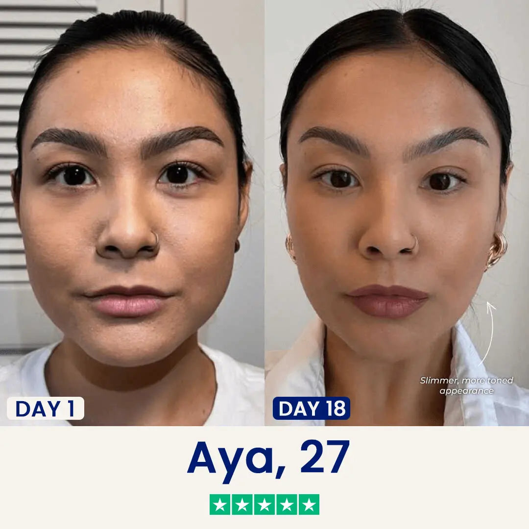 The Chinology™ Lift (v3) Chinology US