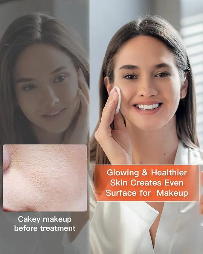 Chinology LED Wrinkle Mask – Eliminate Your Wrinkles Now with Chinology (OFFER EXCLUSIVE TO CUSTOMERS) Chinology™ US